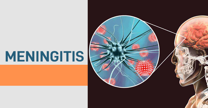 Confirman primer fallecido  con síntomas de meningitis en  Tamaulipas. Se investigan clínicas privadas de decirugía estética en la ciudad de Matamoros.